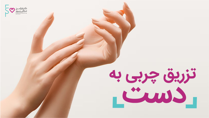 تزریق چربی به دست